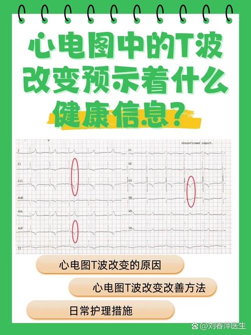 心電圖中的t波改變預(yù)示著什么健康信息?